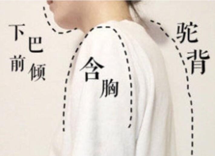 南寧美容學(xué)校：堅(jiān)持一個(gè)月，駝背變直背