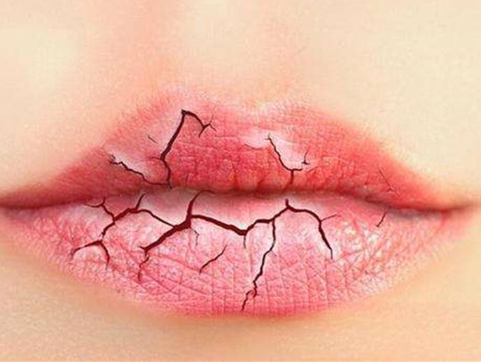 6個美容技巧，解決秋季嘴唇干燥
