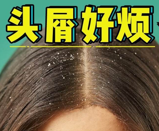 南寧正規(guī)美發(fā)培訓學校分享：冬天如何減少頭屑過多？