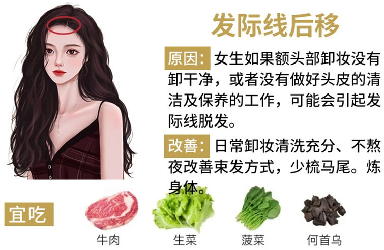 如何改善掉頭發(fā)？南寧頭療養(yǎng)發(fā)護(hù)發(fā)教學(xué)