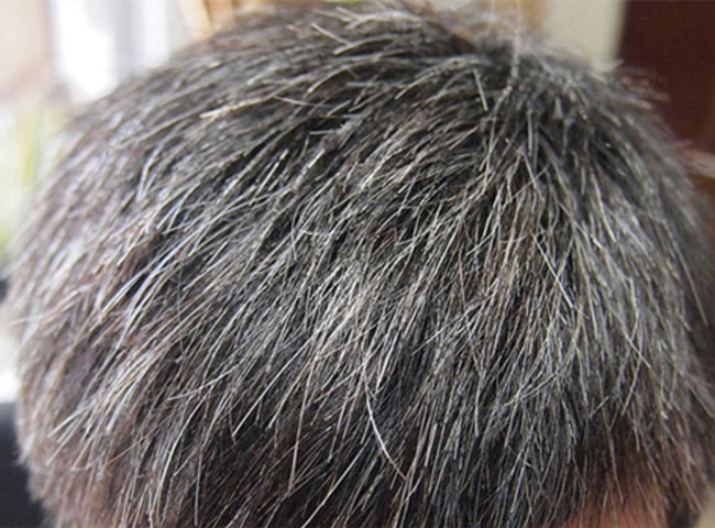 南寧美發(fā)基礎教學：為什么會長白頭發(fā)？